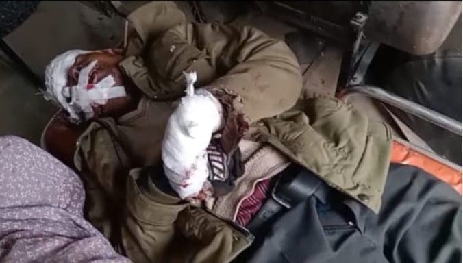 ट्रेन की चपेट में आने से रोडवेज कर्मचारी घायल