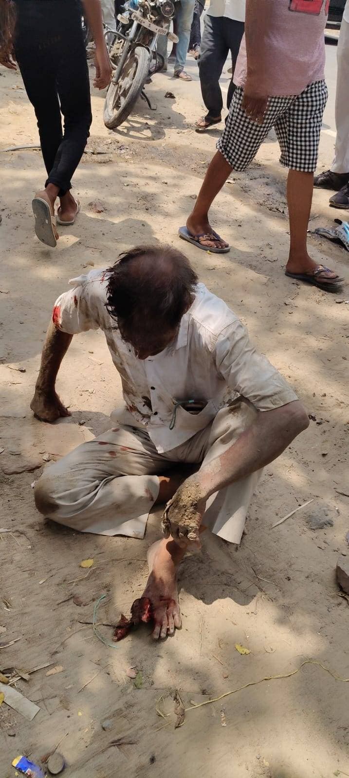 बाइक और साइकिल की टक्कर में चार घायल, जिला अस्पताल रेफर। मदरिया